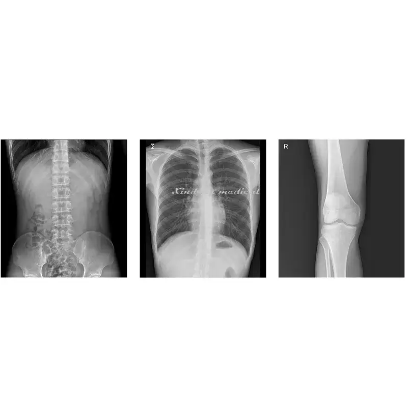 Tiêu đề mới: Sản phẩm X-quang di động Dr với công nghệ tiên tiến cho y tế và thú y