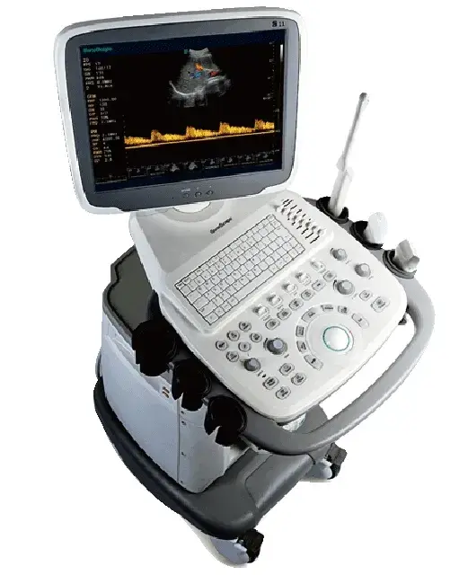 Máy siêu âm di động Sonoscape E2 với chức năng chẩn đoán tim mạch Doppler màu và đầu dò Echo