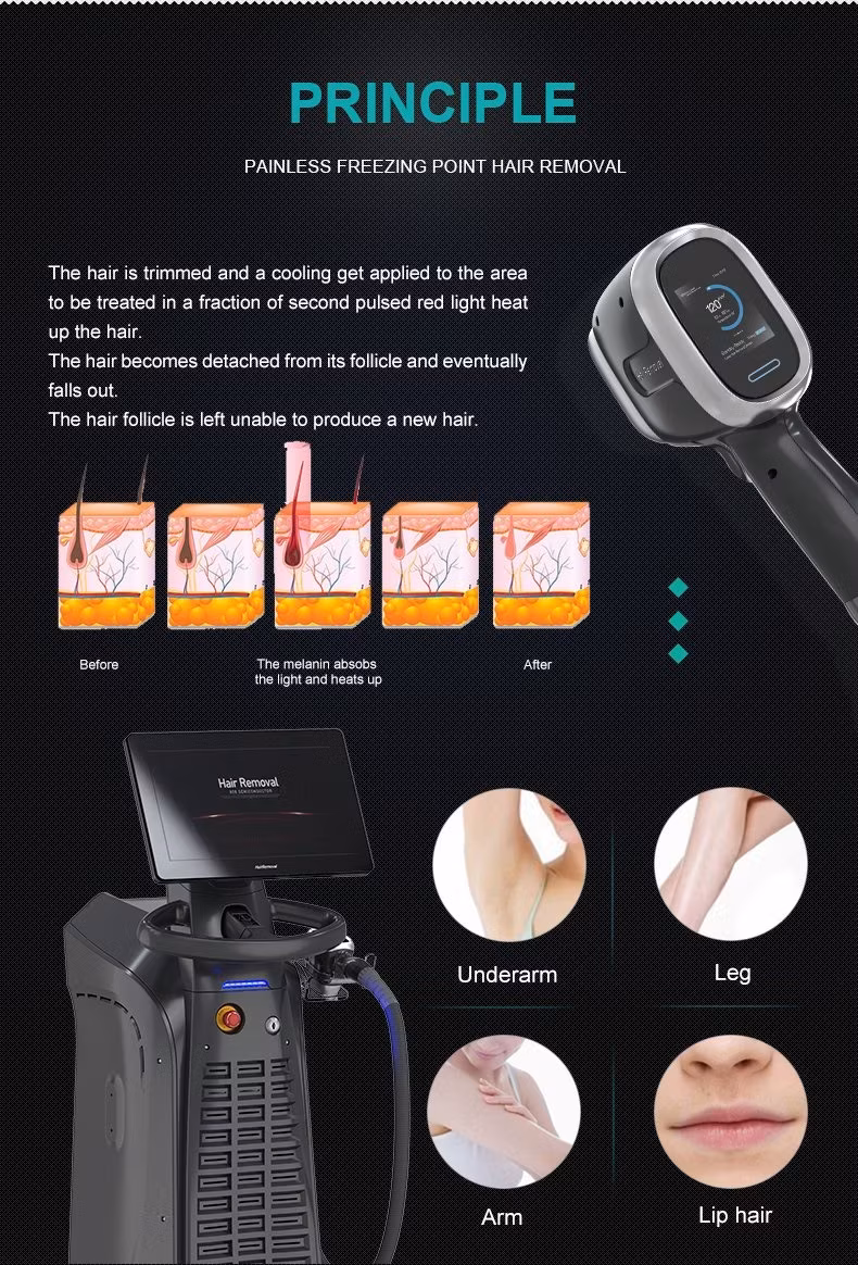 Máy Triệt Lông Laser Diode 808nm 755nm 1064nm 940nm - Hiệu Quả Cao và An Toàn hình ảnh 14-description