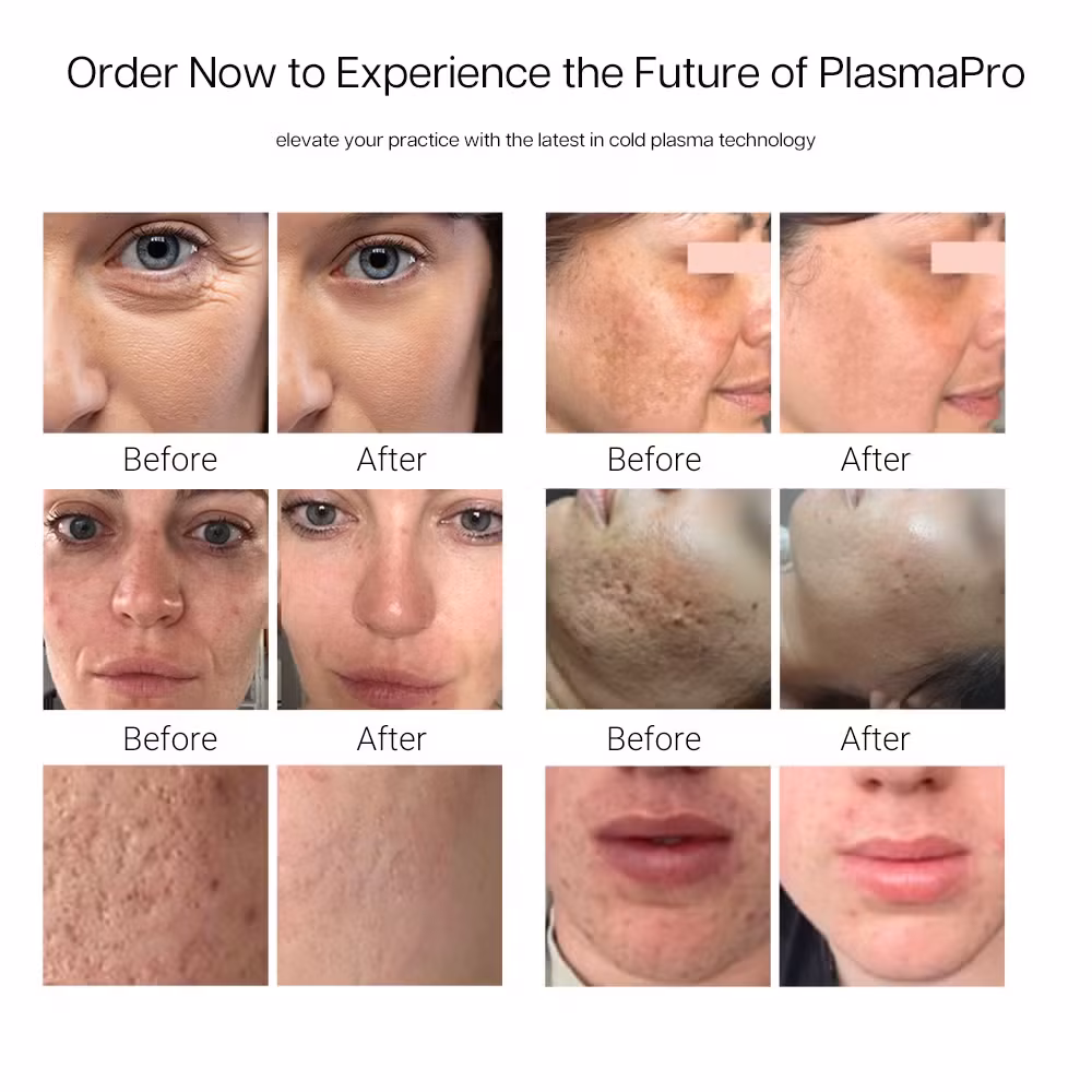 Thiết Bị Chăm Sóc Da Mặt Chuyên Nghiệp 11 trong 1: Máy Plasma Nóng Lạnh Ozone Bút Plasma, Xóa Mụn Mí Mắt Lạnh hình ảnh 18-description