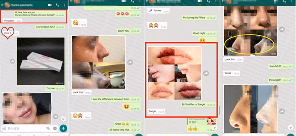 CE 1ml - Chất làm đầy tiêm liên kết chéo Axit Hyaluronic cho bút Hyaluronic tại đây hình ảnh 18-description