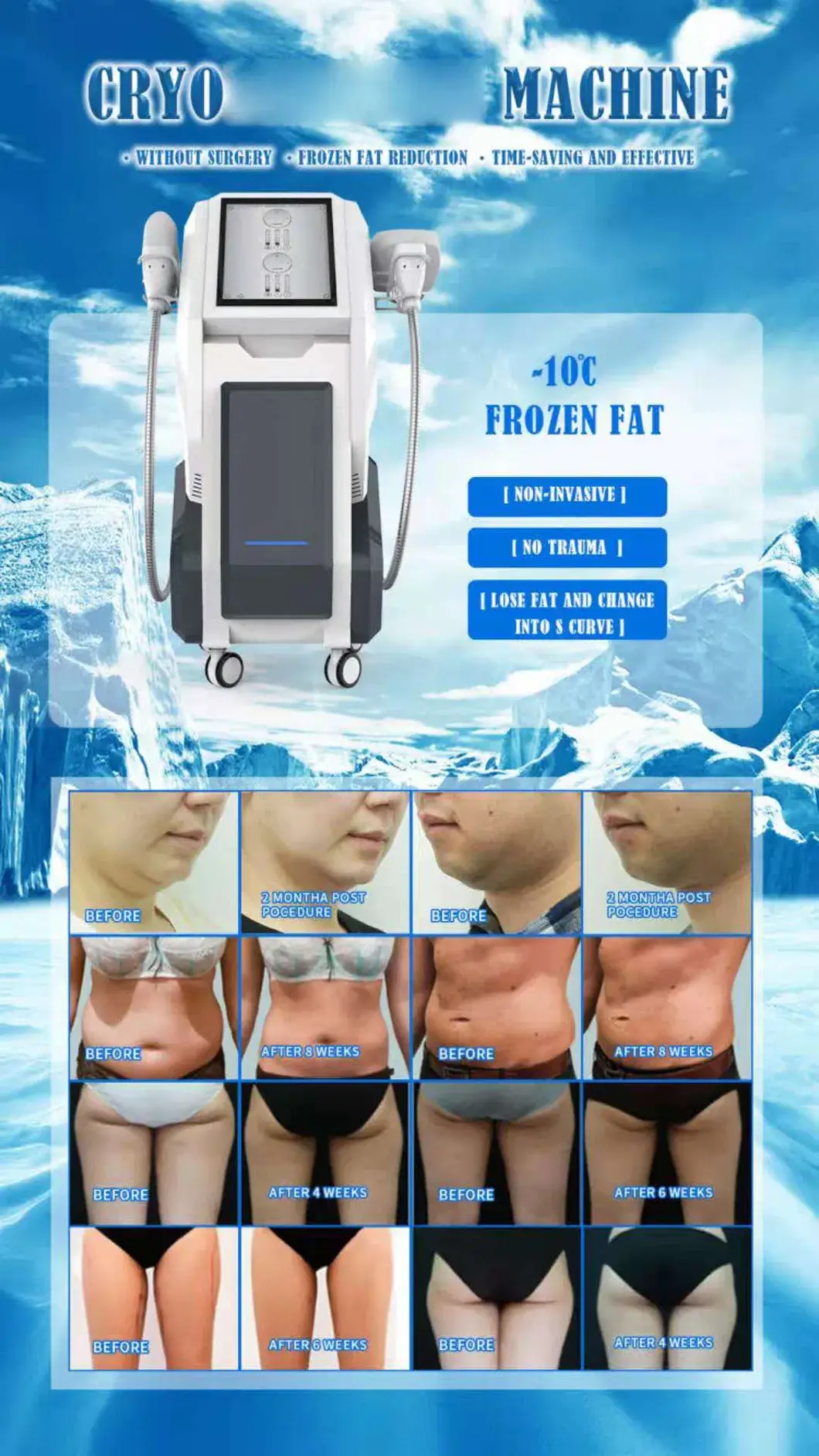 Máy làm mát Cryo 5D 2021 - Thiết bị giảm mỡ không xâm lấn, hiệu quả, an toàn hình ảnh 15-description