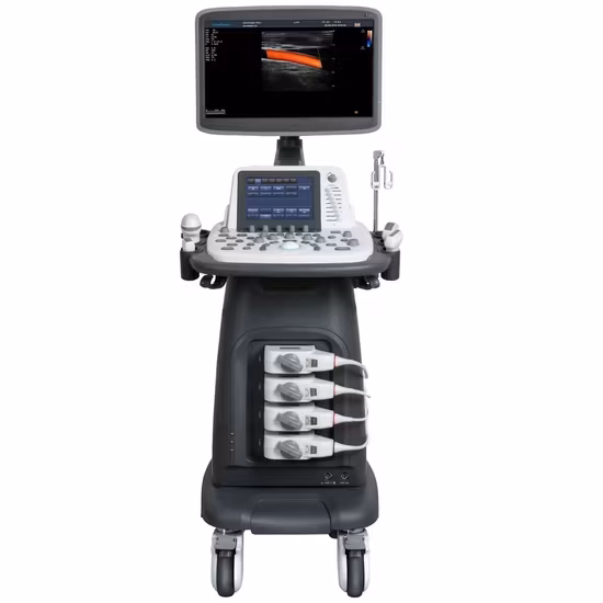 Máy siêu âm di động Sonoscape E2 với chức năng chẩn đoán tim mạch Doppler màu và đầu dò Echo