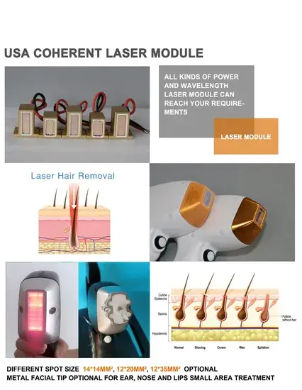 Tẩy lông bằng công nghệ laser Diode và Alexandrite 755nm - Khuyến mãi mới nhất 2024