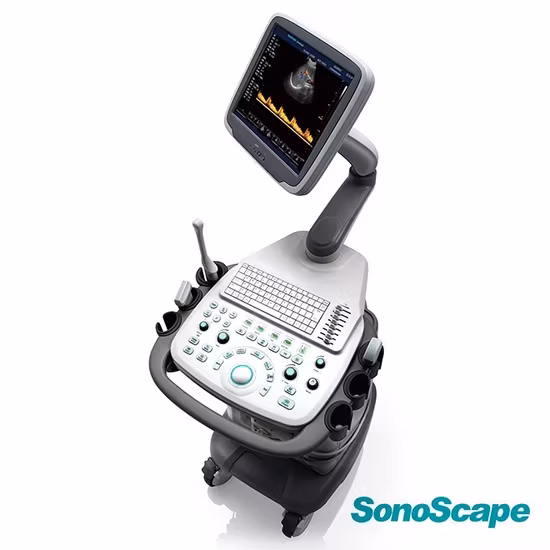 Máy siêu âm di động Sonoscape E2 với chức năng chẩn đoán tim mạch Doppler màu và đầu dò Echo