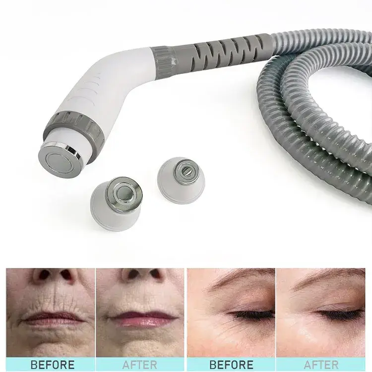 Máy Triệt Lông Bằng Laser YAG 4 trong 1: Công Suất Lớn và Hiệu Quả hình ảnh 21-description