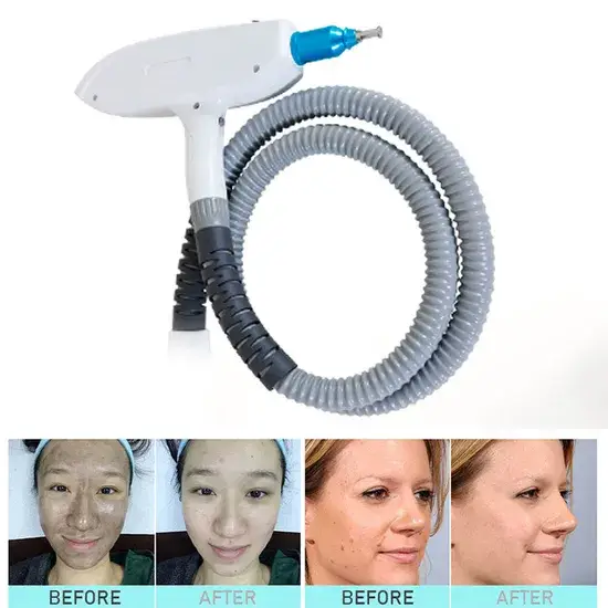 Máy Triệt Lông Bằng Laser YAG 4 trong 1: Công Suất Lớn và Hiệu Quả