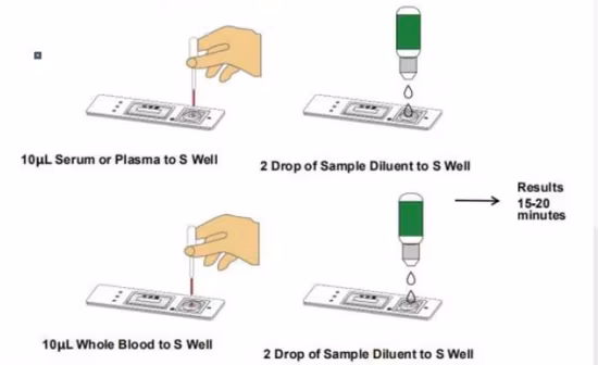 Bộ xét nghiệm nhanh kháng thể IgG IgM được chứng nhận bởi FDA, phù hợp cho việc tự kiểm tra tại nhà