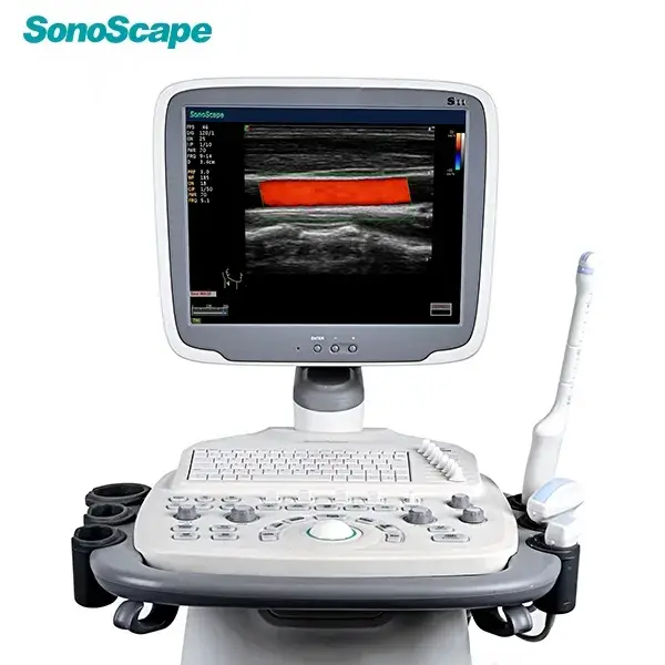 Máy siêu âm di động Sonoscape E2 với chức năng chẩn đoán tim mạch Doppler màu và đầu dò Echo