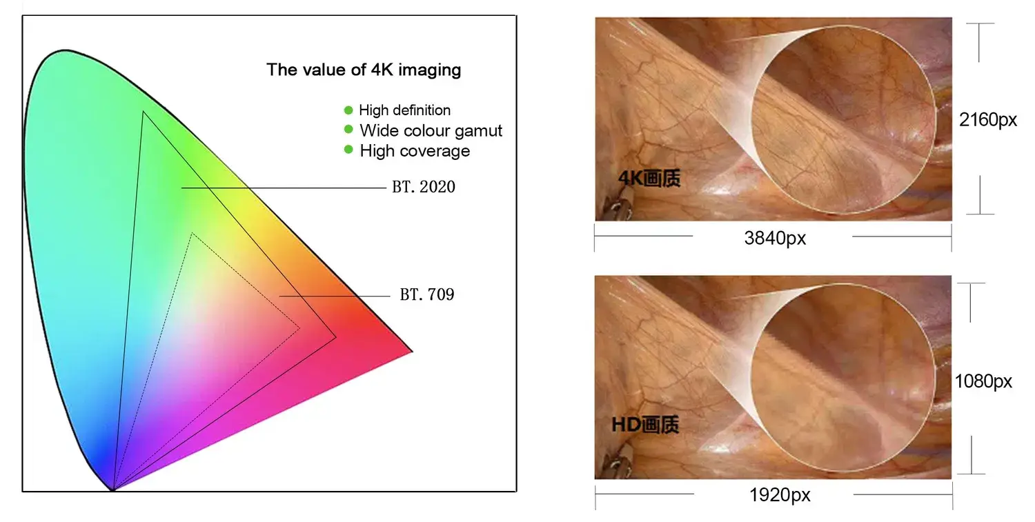 Hệ thống Nội soi Y tế 4K UHD Huỳnh quang - Giải pháp tối ưu cho Phẫu thuật Cứng