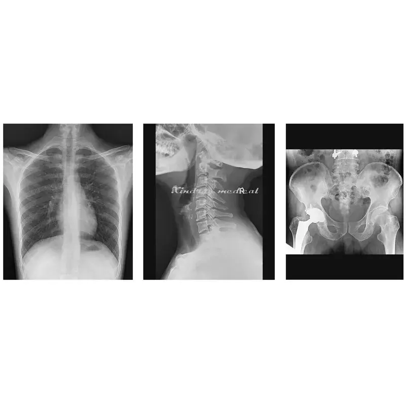 Tiêu đề mới: Sản phẩm X-quang di động Dr với công nghệ tiên tiến cho y tế và thú y