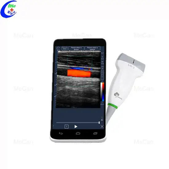 Máy siêu âm cầm tay: Lựa chọn tốt cho việc chăm sóc sức khỏe