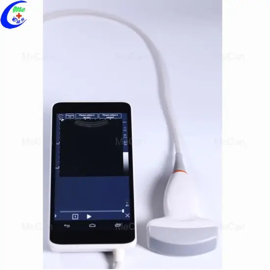Máy siêu âm cầm tay: Lựa chọn tốt cho việc chăm sóc sức khỏe