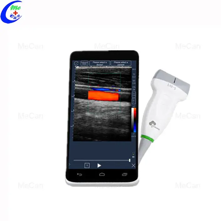 Máy siêu âm cầm tay: Lựa chọn tốt cho việc chăm sóc sức khỏe