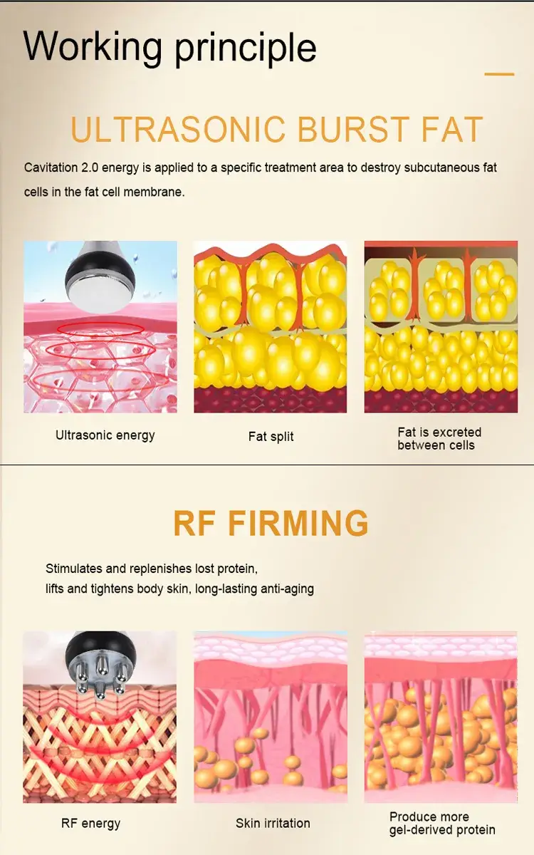 Giảm cellulite hiệu quả với sóng radio tần số chân không cavitation - Giải pháp từ nhà sản xuất hình ảnh 16-description