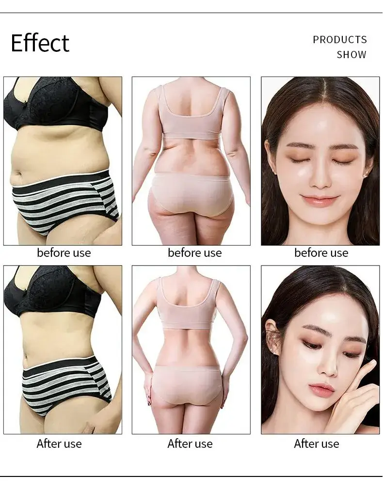 Giảm cellulite hiệu quả với sóng radio tần số chân không cavitation - Giải pháp từ nhà sản xuất hình ảnh 17-description
