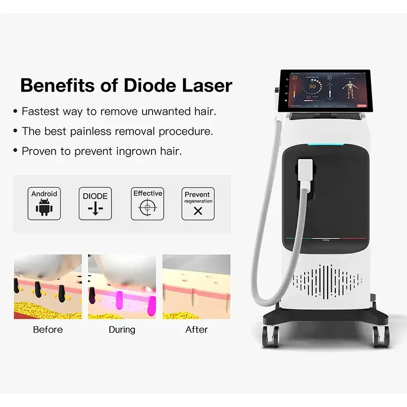 Máy triệt lông chuyên nghiệp sử dụng công nghệ laser Alexandrite Platinum và diode