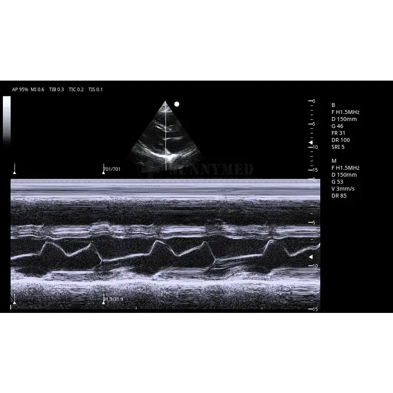 Xe đẩy máy siêu âm thú y Sya-N7 4D/5D Doppler màu: Sự lựa chọn hàng đầu hình ảnh 18-description