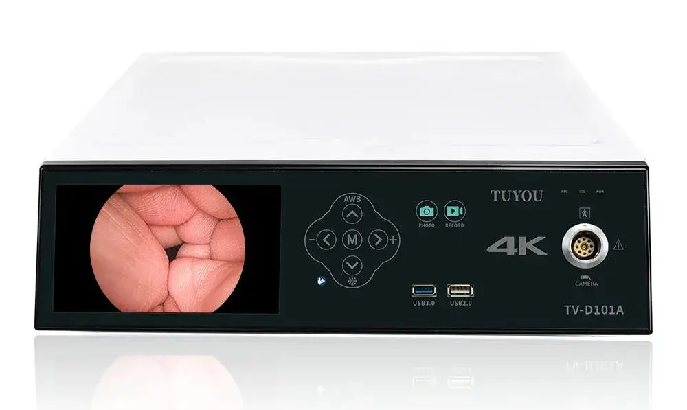 Camera nội soi y tế di động Tuyou: trải nghiệm với màn hình, hình ảnh và tính năng ghi âm hoàn hảo hình ảnh 5-description