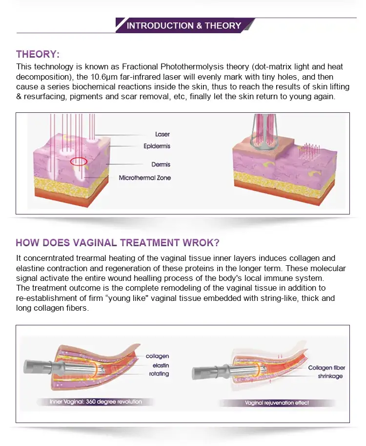 Máy Tạo Điều Kiện Laser Fractional CO2: Giúp Siết Chặt Vùng Kín hình ảnh 15-description