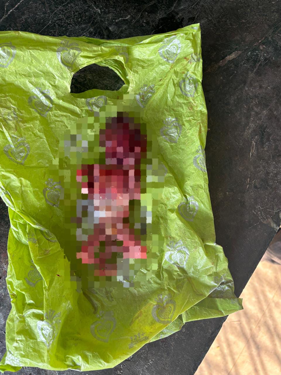 जिला अस्पताल के शौचालय में मिला नवजात भ्रूण, जांच में जुटी पुलिस 