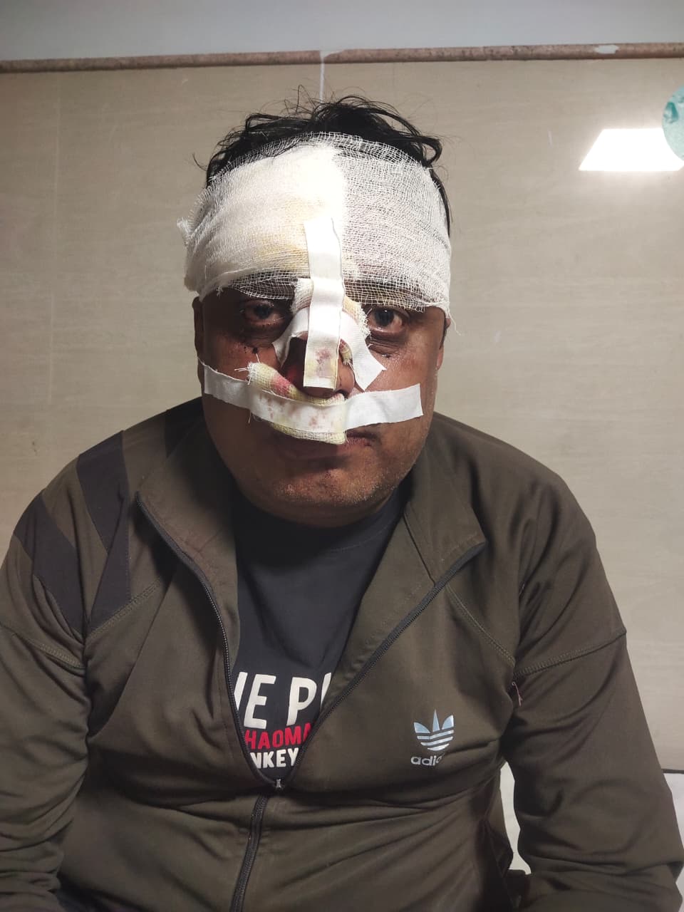 दमोह-सागर रोड पर इलेक्ट्रॉनिक व्यापारी से 7 लाख की लूट, जांच में जुटी पुलिस