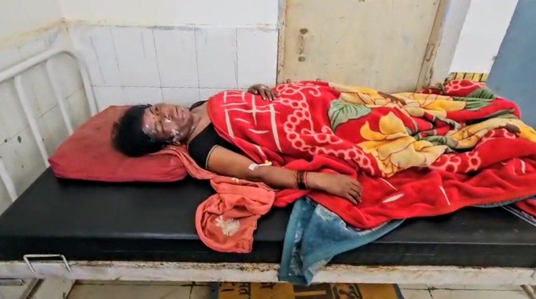 दमोह में खोलते पानी से महिला पर हमला, हालत गंभीर अज्ञात आरोपियों की तलाश में जुटी पुलिस.... posted by Akib Khan from Damoh