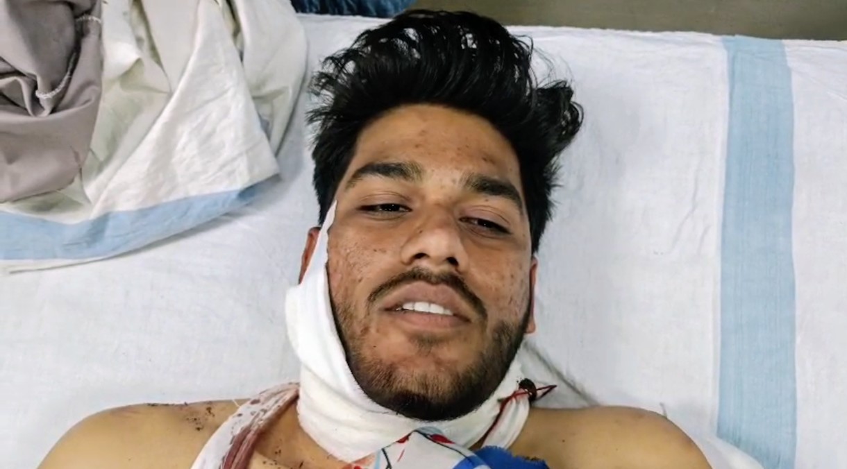 दमोह में घर में घुसकर युवक पर चाकू से हमला, हालत गंभीर जबलपुर रेफर..