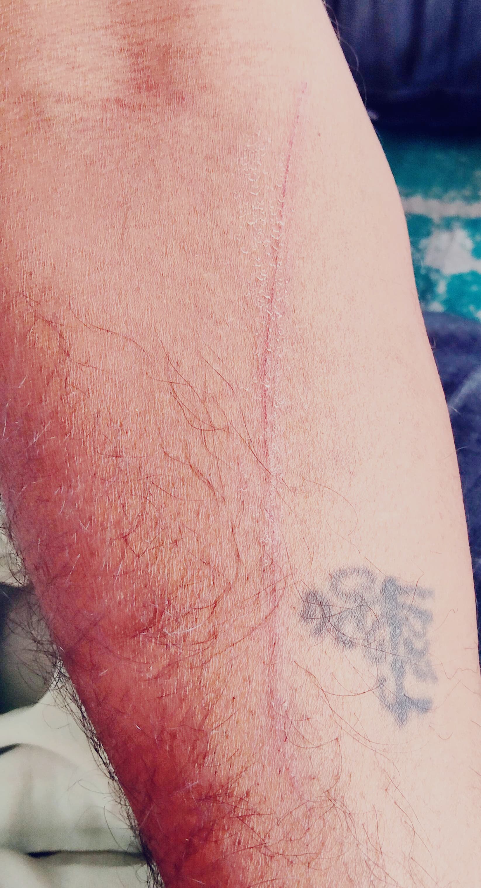 आमाड़ोह की टेकड़ी पर रफाड़ में लगी आग, दमकल टीम पर हमला posted by Mohammad Asif Langha from Amla