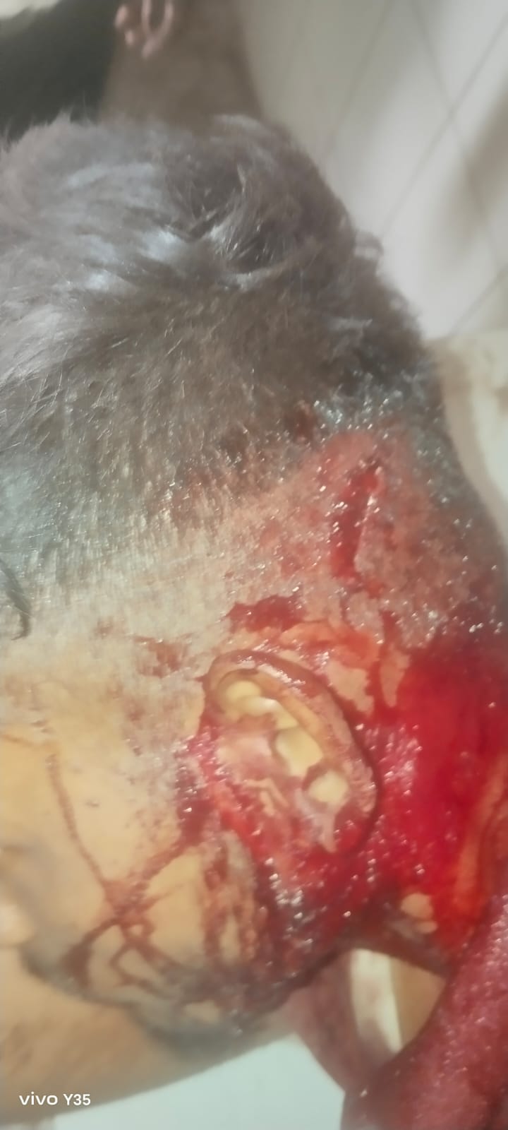 Additional News Image