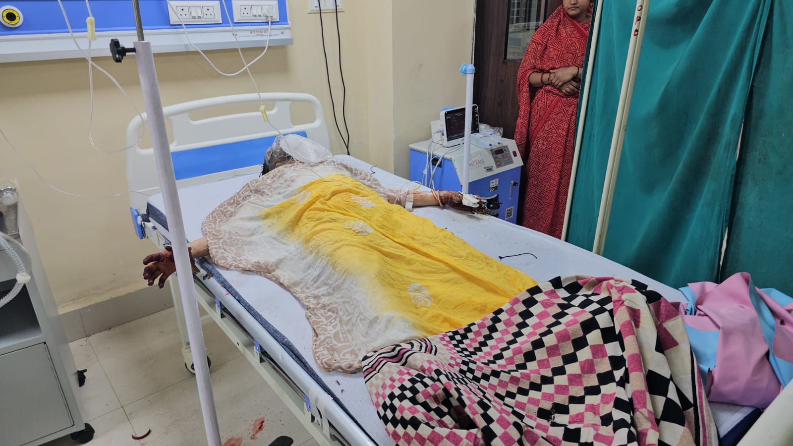 पत्नी को जलाने के आरोप में पति गिरफ्तार posted by Ved Parkash Arya from Guna