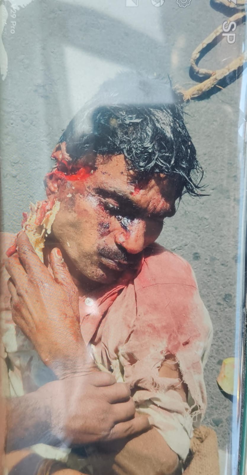 प्रेम प्रसंग बना मौत की वजह: खाना खाते समय कुल्हाड़ी से हत्या, बोरे में भरकर हाईवे पर फेंका शव सागर। सागर-कानपुर हाईवे पर बंद बोरे में मिली  posted by Kartik Gautam from Sagar