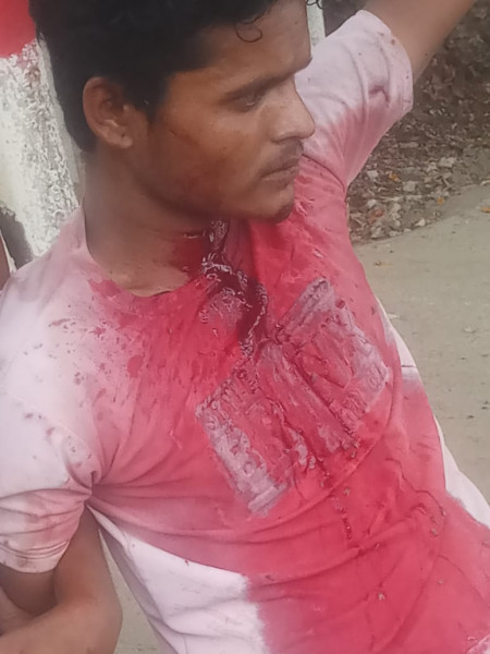 गुस्से में खुद के गले में युवक ने घौप लिया चाकू, बेलखेड़ा के मनकेड़ी का मामला