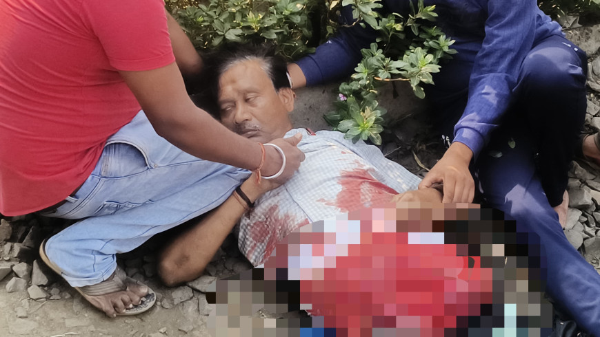 Jabalpur News: ट्रेनों के बीच फंसकर युवक 2 हिस्सों में कटा, जिंदा धड़ लेकर मेडिकल पहुंचे परिजन