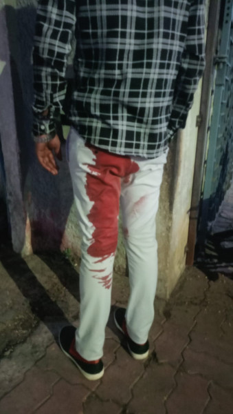 Jabalpur News: डायल-100 वाले भी सुरक्षित नहीं, अब चालक को आदतन बदमाश ने मुखबरी के शक में मारी चाकू