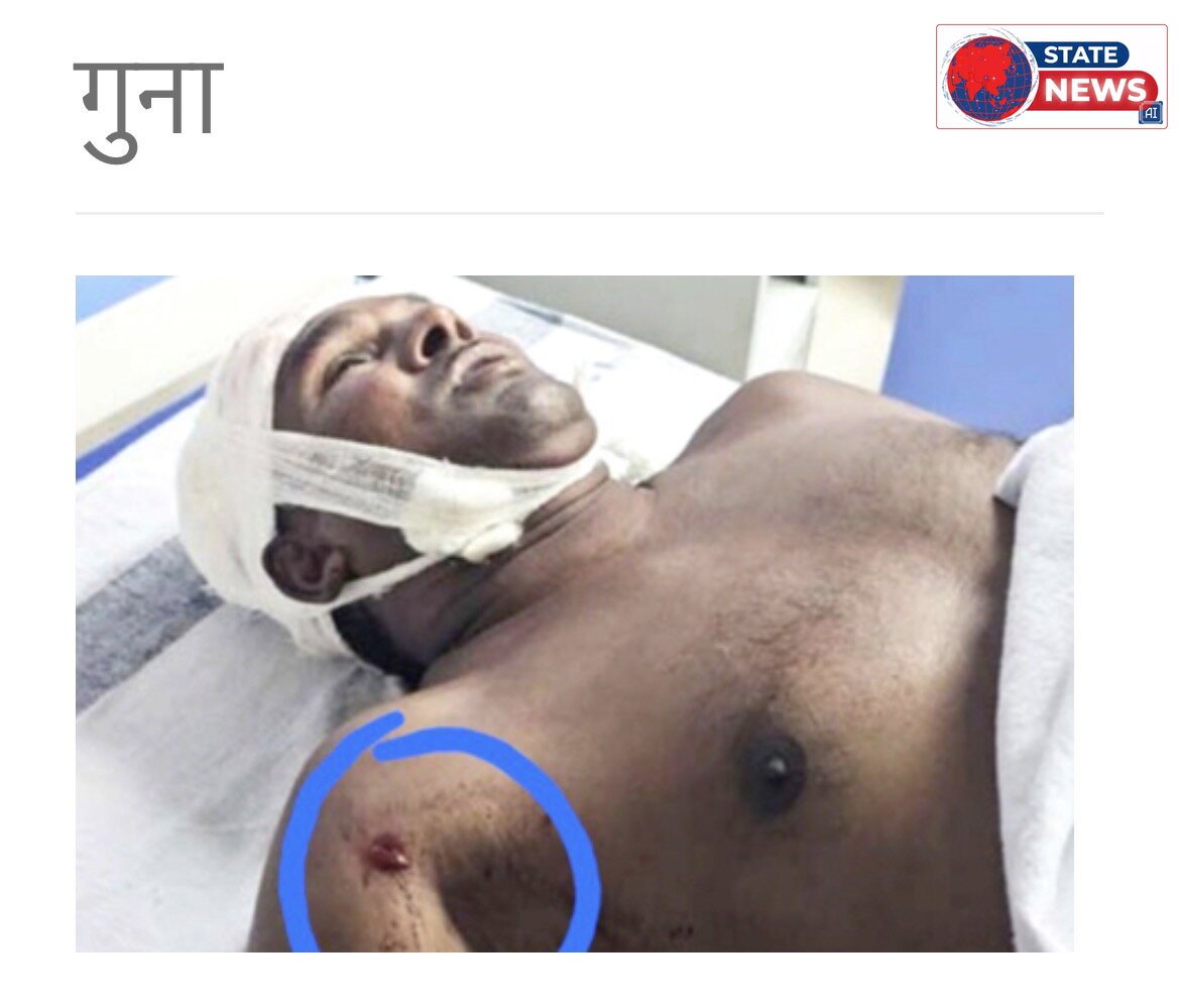 गुना: ईदगाह बाड़ी में मछली पकड़ने के पुराने विवाद को लेकर खूनी संघर्ष, फायरिंग में एक युवक घायल