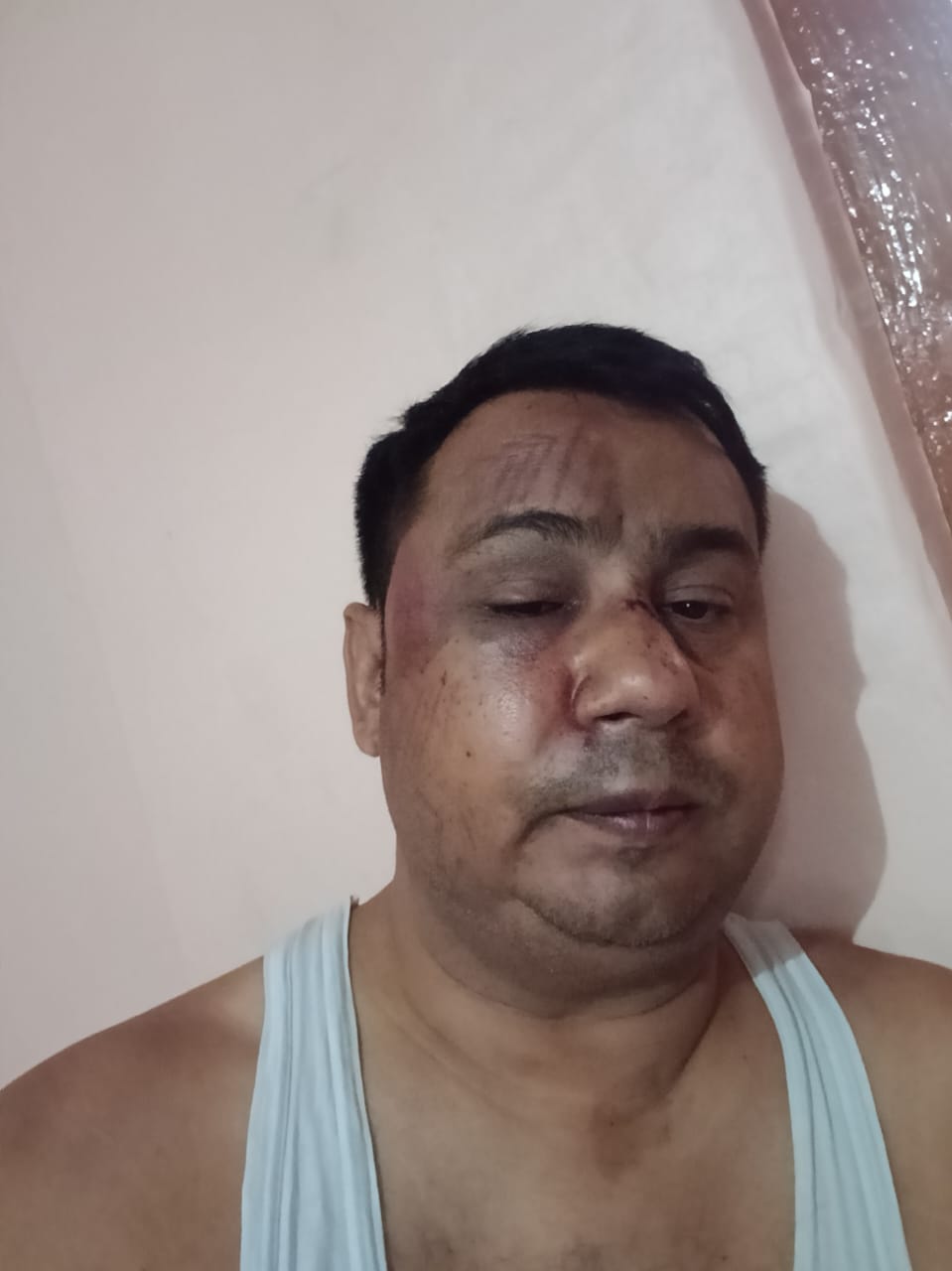 फोन कर अस्पताल बुलाया, डॉक्टर पर हमला; मारपीट में प्रभारी बीएमओ बेहोश