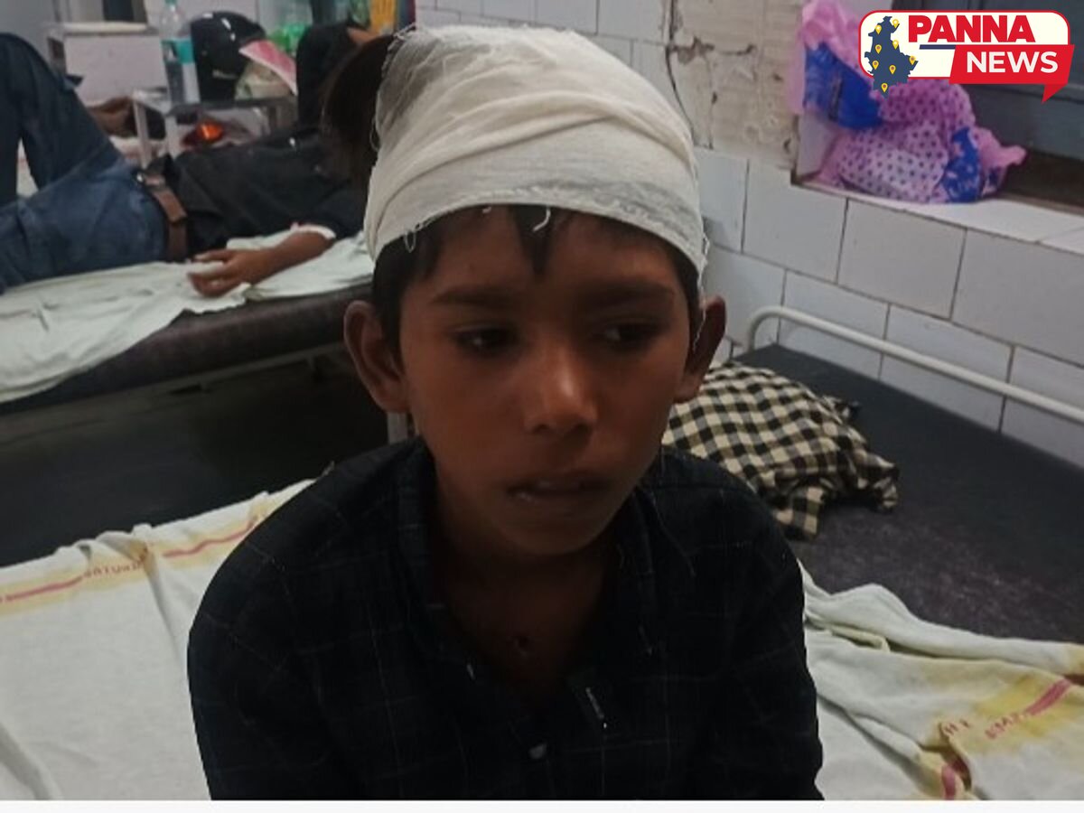 पन्ना: बंदर के हमले में मासूम बालक गंभीर रूप से घायल