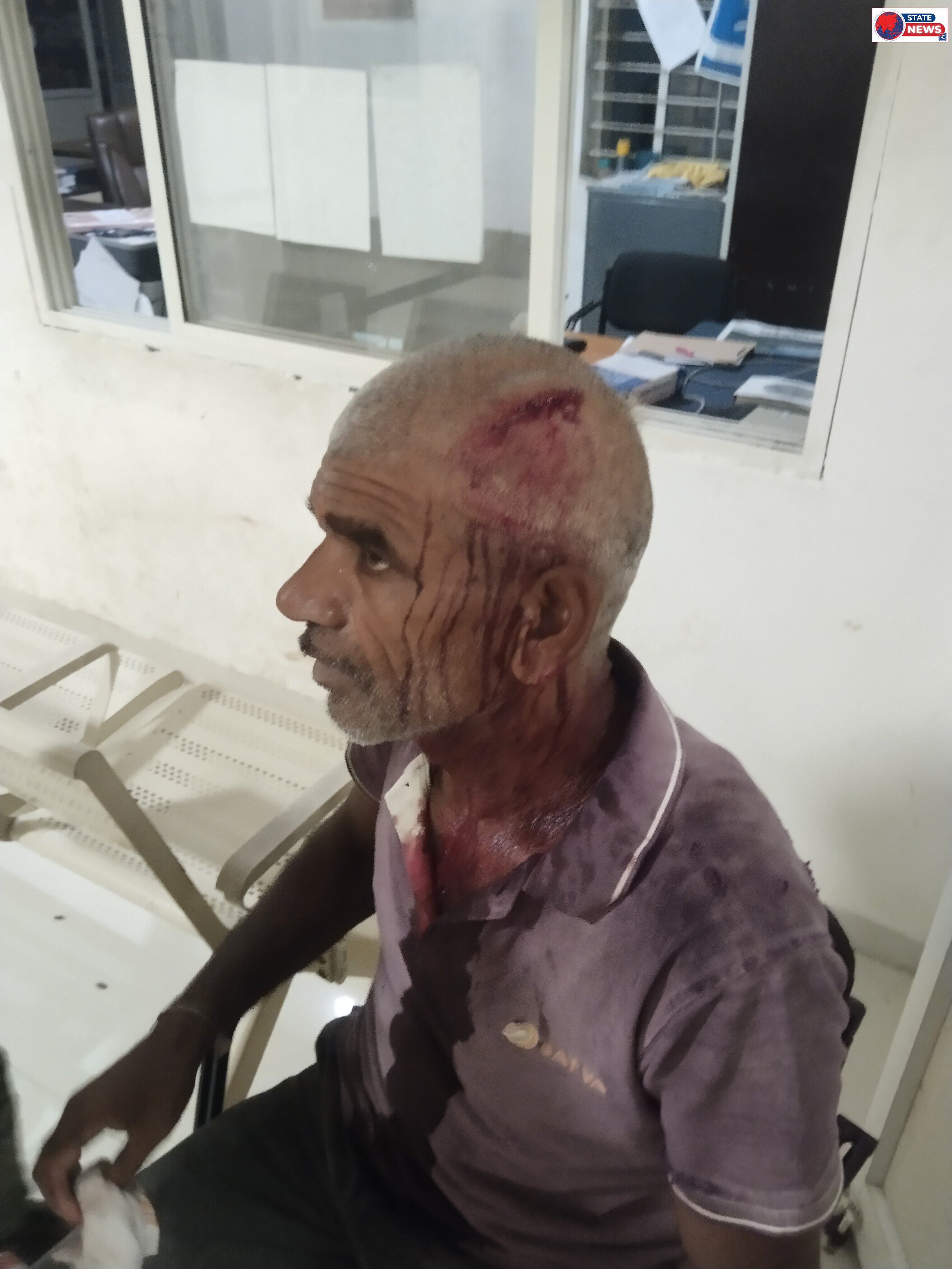 शाजापुर: खेत की मेढ़ से ट्रैक्टर निकालने को लेकर खूनी संघर्ष, पड़ोसी ने लाठी से हमला कर बुजुर्ग का सिर फोड़ा