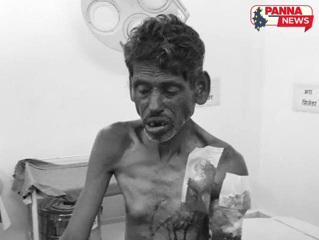 पन्ना में तेंदुए का हमला: जंगल में भैंस चरा रहे चरवाहे को बनाया शिकार, कटनी मेडिकल कॉलेज रेफर