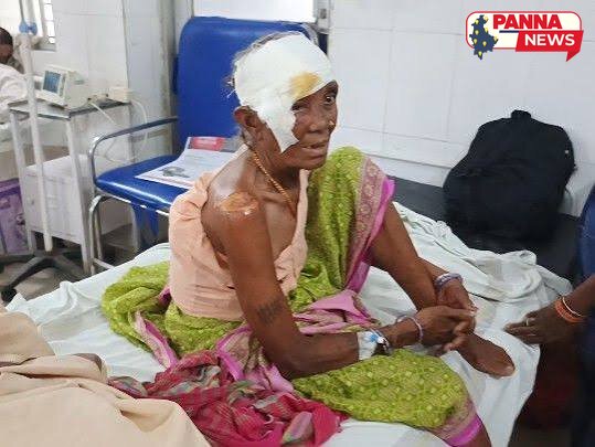 पन्ना में दर्दनाक सड़क हादसा: बाइक के सामने कुत्ता आने से 20 फीट तक घिसटी 75 वर्षीय वृद्ध महिला, हालत गंभीर