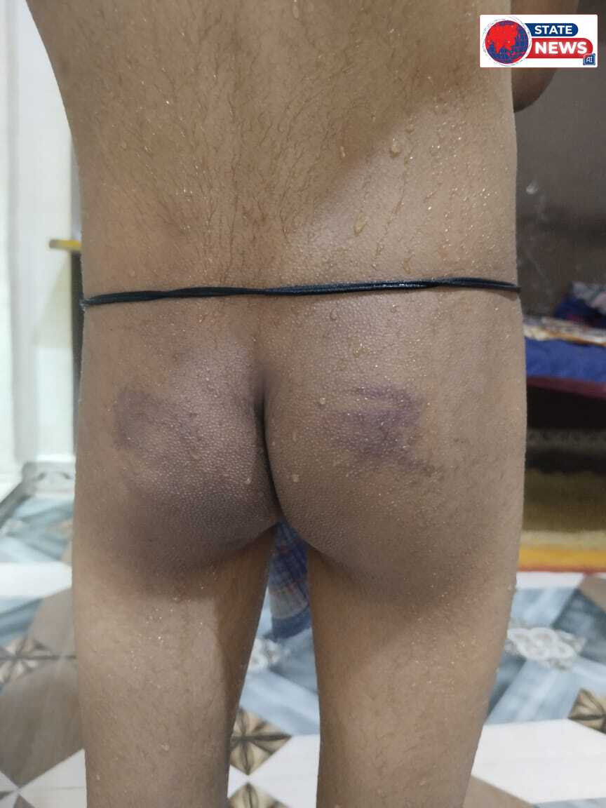 समर्थ एडवांस एकेडमी खिमलासा पर आरोप 