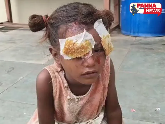 पन्ना: शाहनगर क्षेत्र में तेंदुए या सियार के हमले से मची दहशत, मां ने बचाई मासूम की जान