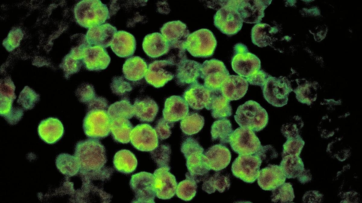 ICMR Study Links Kerala's Well Water to Increased Risk of Amoebic Meningoencephalitis