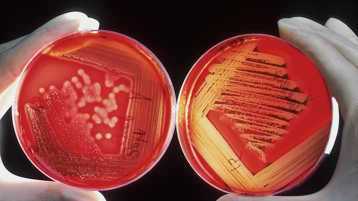Breakthrough in Universal Vaccine Development Offers Hope Against Pneumonia and Meningitis