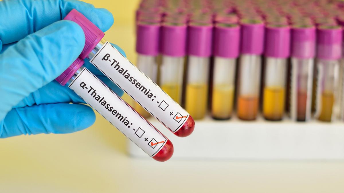 1,000 Transplants: New Hope for Thalassemia Patients in [Location]