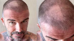 Is David Beckham Going Bald? Ex-Footballer’s Buzz Cut Failure Leaves Internet in...