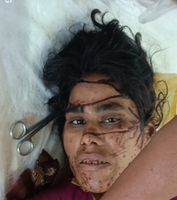 रेलवे ट्रैक किनारे घायल मिली महिला, आमला-नागपुर रेलखंड में हड़कंप