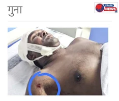 गुना: ईदगाह बाड़ी में मछली पकड़ने के पुराने विवाद को लेकर खूनी संघर्ष, फायरिंग में एक युवक घायल