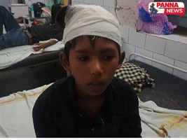 पन्ना: बंदर के हमले में मासूम बालक गंभीर रूप से घायल